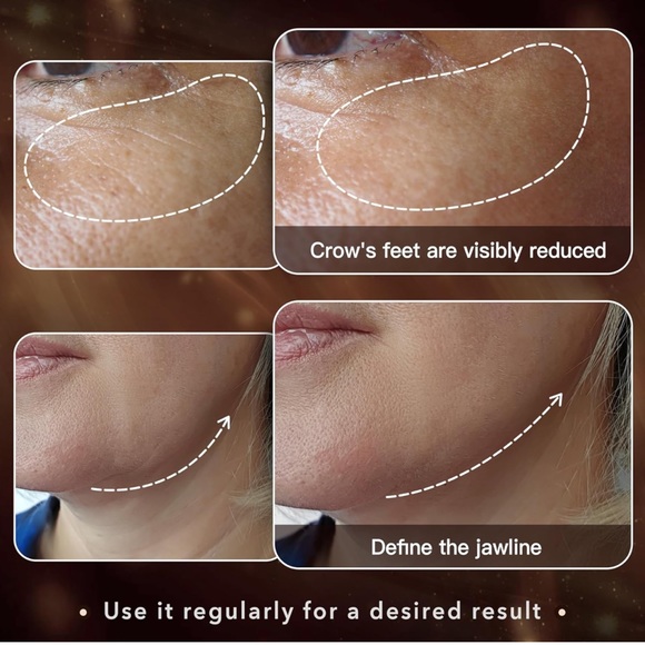 Mlay face machine - Picture 11 of 12